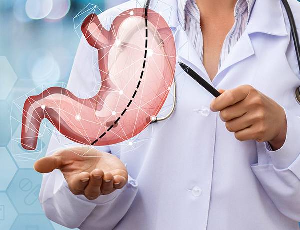 Gastric Sleeve
