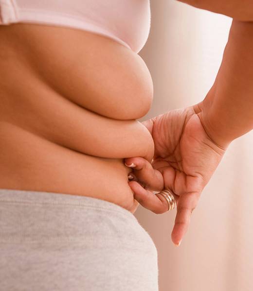 Obesity